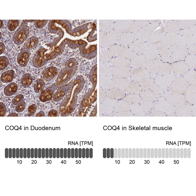 COQ4 Antibody in Immunohistochemistry (Paraffin) (IHC (P))