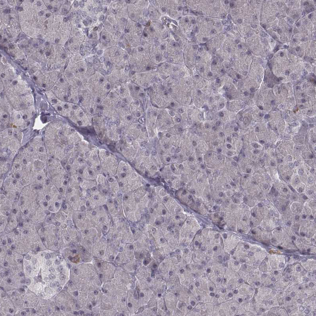 RPGRIP1 Antibody in Immunohistochemistry (Paraffin) (IHC (P))