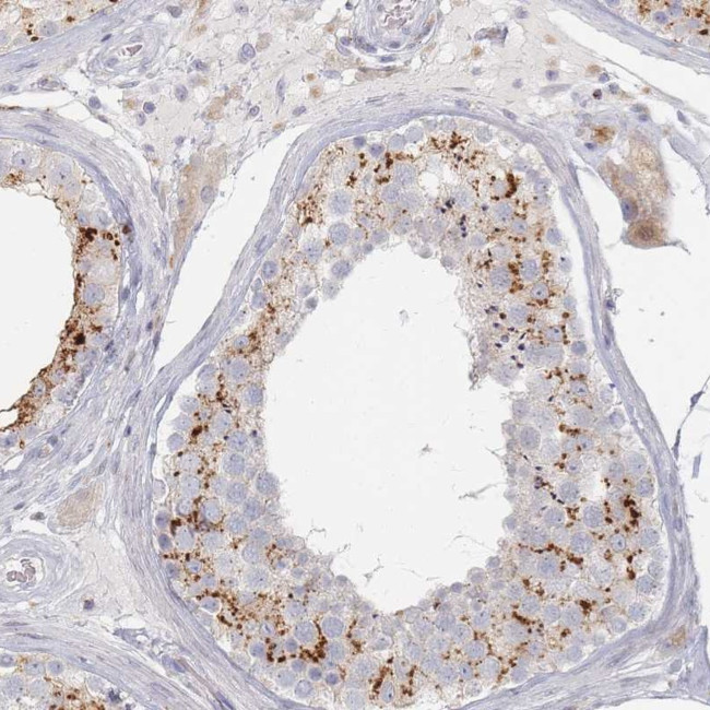 SLC2A11 Antibody in Immunohistochemistry (Paraffin) (IHC (P))