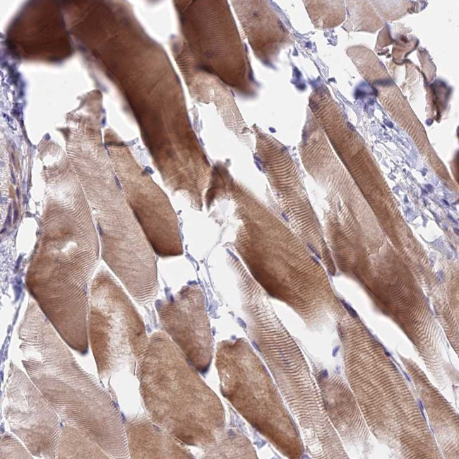 DUPD1 Antibody in Immunohistochemistry (Paraffin) (IHC (P))