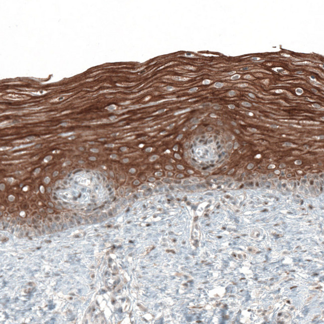 PAPD5 Antibody in Immunohistochemistry (IHC)