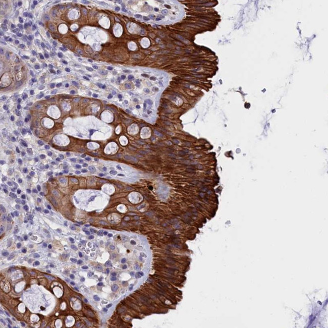C16orf62 Antibody in Immunohistochemistry (Paraffin) (IHC (P))