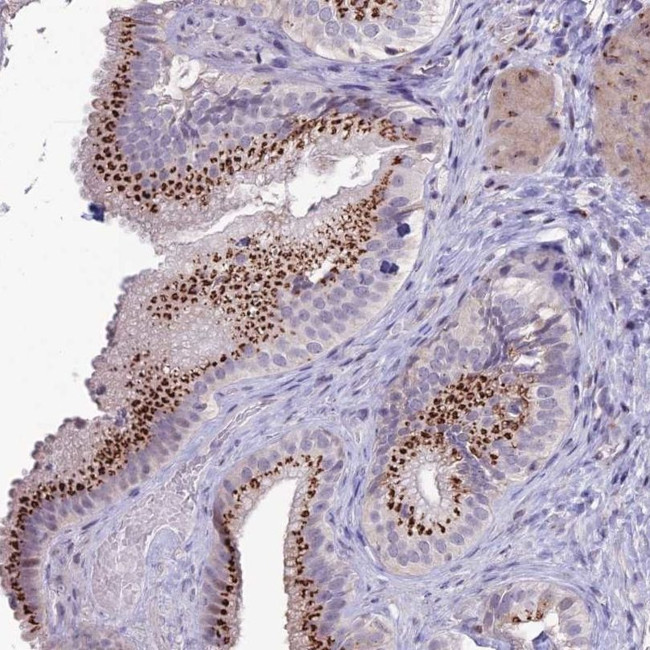 PLEKHA4 Antibody in Immunohistochemistry (IHC)