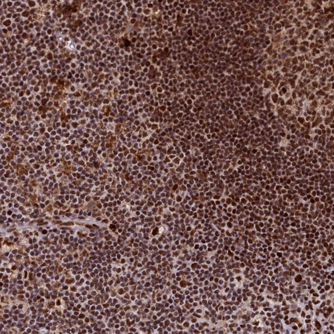 SF3B3 Antibody in Immunohistochemistry (Paraffin) (IHC (P))