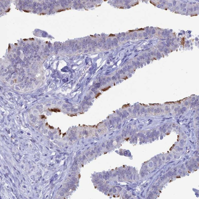 CCDC173 Antibody in Immunohistochemistry (Paraffin) (IHC (P))
