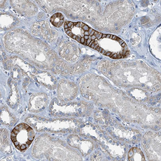 RASA4 Antibody in Immunohistochemistry (Paraffin) (IHC (P))