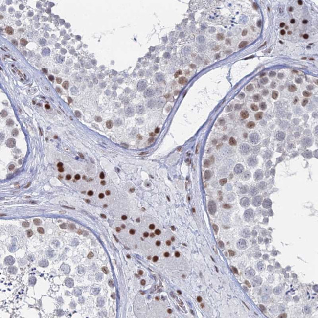 GSC2 Antibody in Immunohistochemistry (Paraffin) (IHC (P))