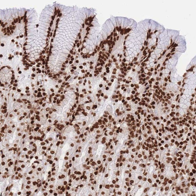 HIST2H2BE Antibody in Immunohistochemistry (IHC)