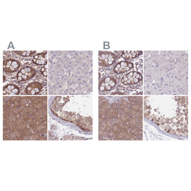 PFDN6 Antibody in Immunohistochemistry (IHC)