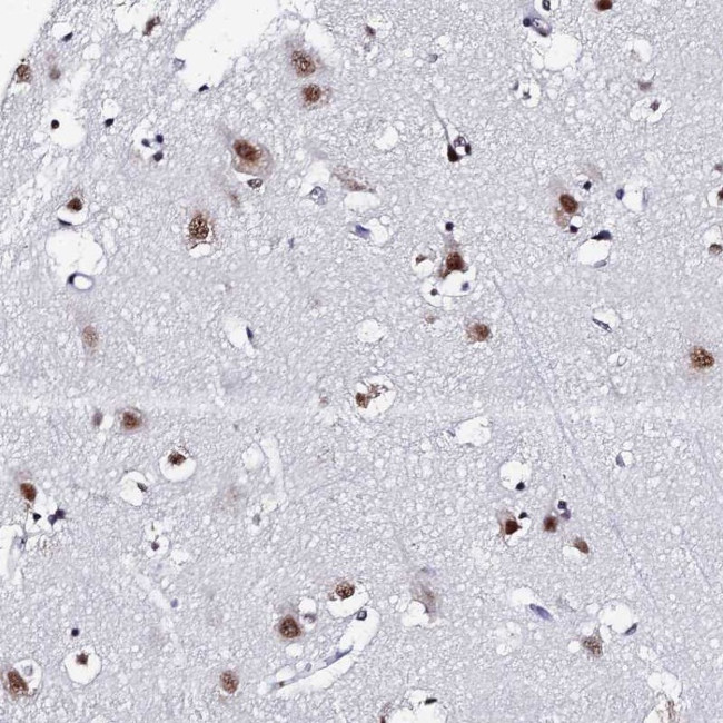 MAGOH Antibody in Immunohistochemistry (Paraffin) (IHC (P))