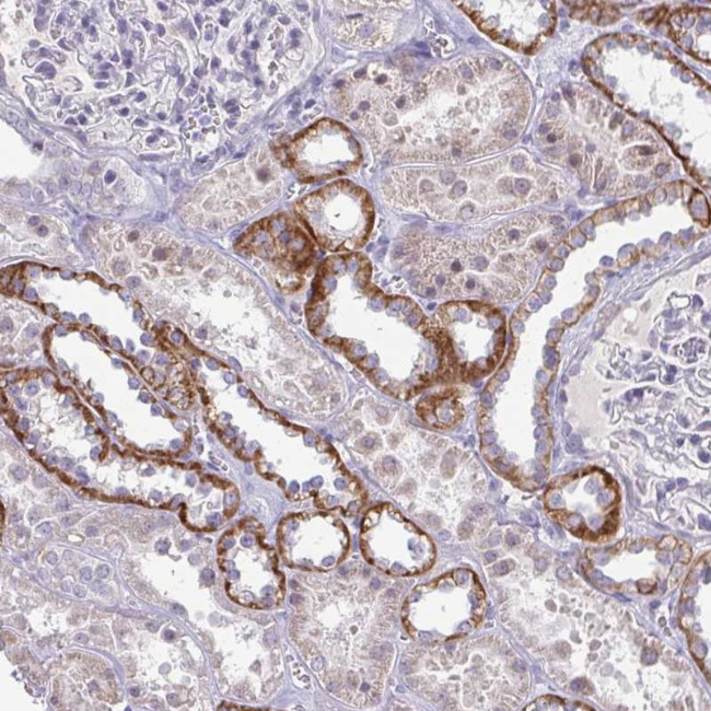 RNaseH1 Antibody in Immunohistochemistry (Paraffin) (IHC (P))