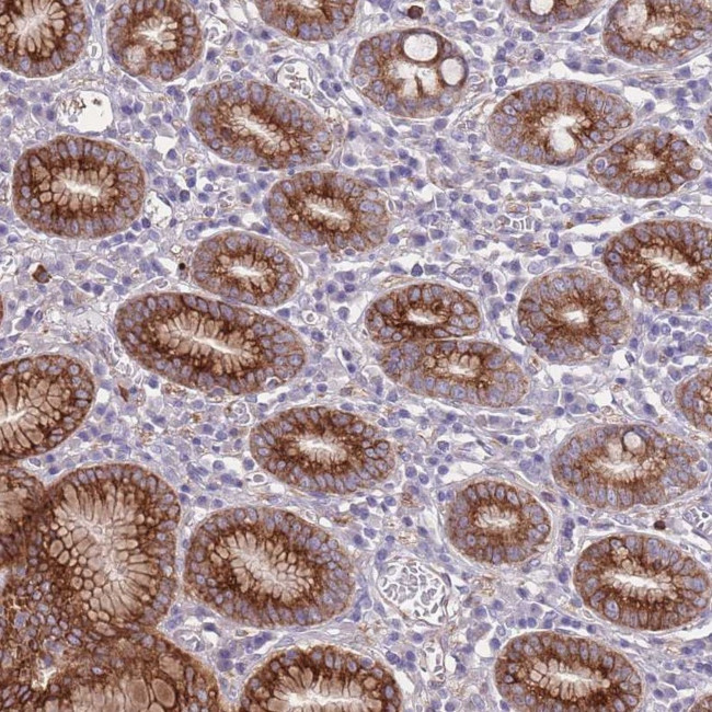 RGS11 Antibody in Immunohistochemistry (Paraffin) (IHC (P))