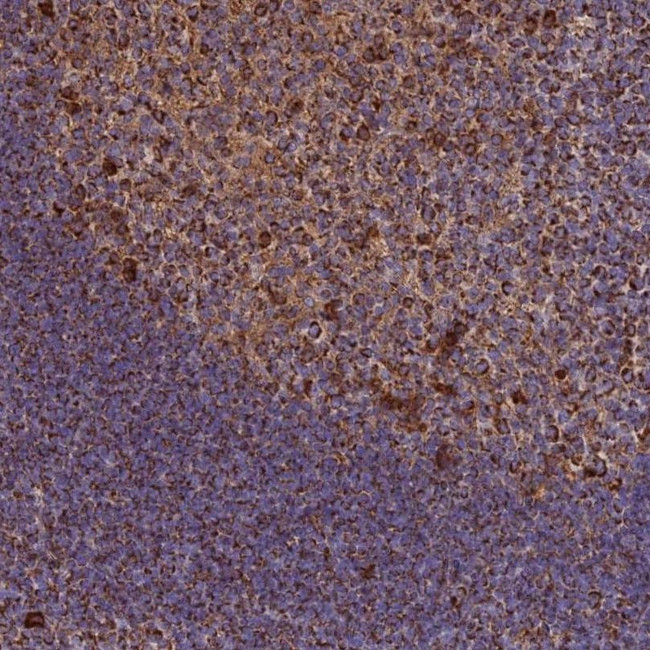 THUMPD2 Antibody in Immunohistochemistry (IHC)