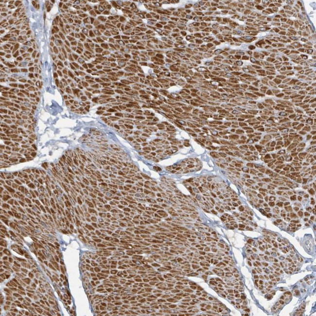 ARGFX Antibody in Immunohistochemistry (Paraffin) (IHC (P))