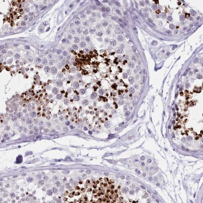 LRRC37A Antibody in Immunohistochemistry (Paraffin) (IHC (P))