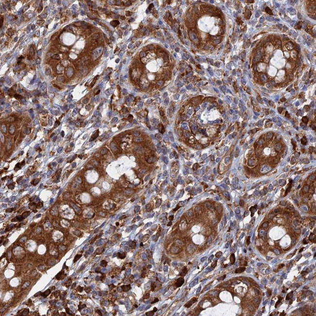 BPIFB6 Antibody in Immunohistochemistry (Paraffin) (IHC (P))