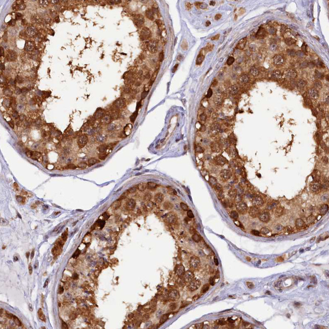 SAMD4A Antibody in Immunohistochemistry (Paraffin) (IHC (P))