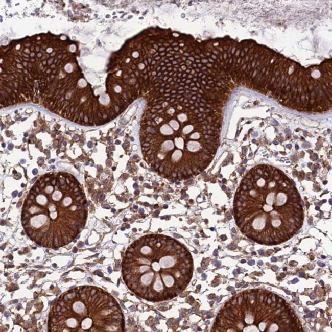 TNIP3 Antibody in Immunohistochemistry (Paraffin) (IHC (P))