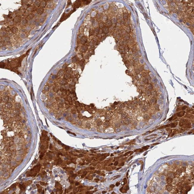 ARL2BP Antibody in Immunohistochemistry (Paraffin) (IHC (P))