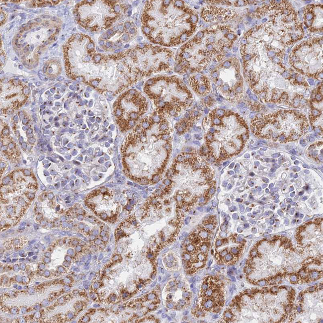 HS2ST1 Antibody in Immunohistochemistry (Paraffin) (IHC (P))