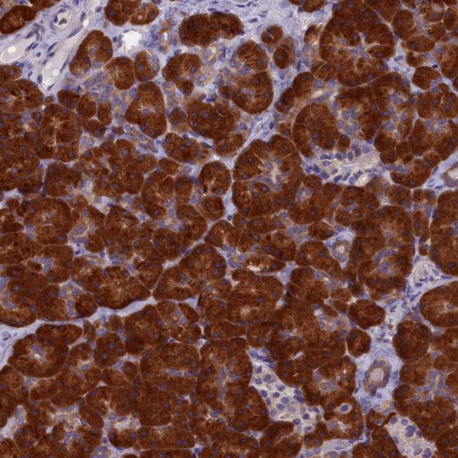 NOL10 Antibody in Immunohistochemistry (Paraffin) (IHC (P))