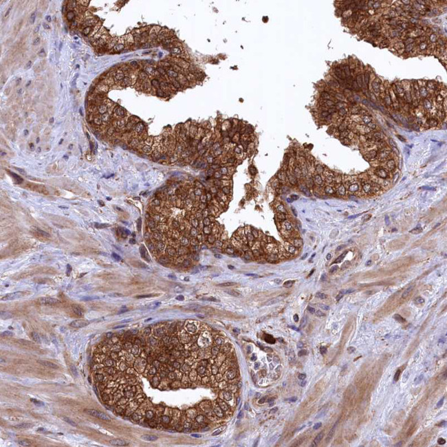 PLA2G4C Antibody in Immunohistochemistry (Paraffin) (IHC (P))