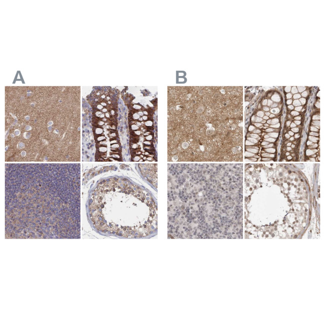 SORBS1 Antibody in Immunohistochemistry (IHC)