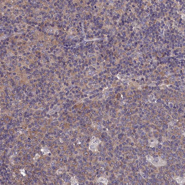 PGP Antibody in Immunohistochemistry (Paraffin) (IHC (P))