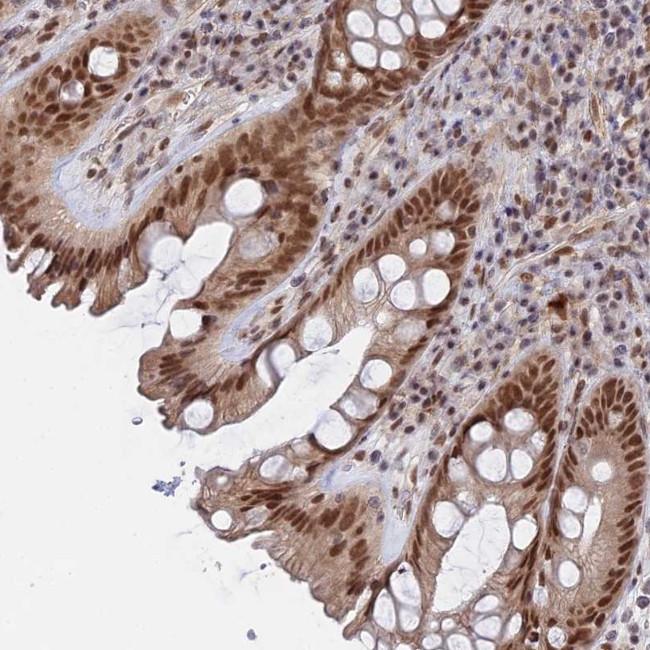 CCDC85A Antibody in Immunohistochemistry (Paraffin) (IHC (P))