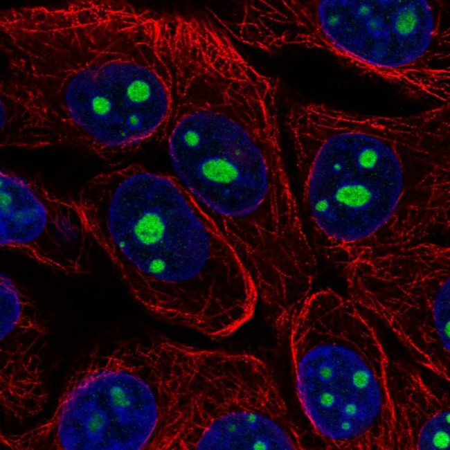 KRI1 Antibody in Immunocytochemistry (ICC/IF)