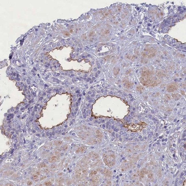 MPV17L2 Antibody in Immunohistochemistry (Paraffin) (IHC (P))