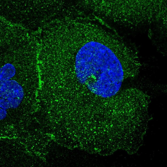FAM193A Antibody in Immunocytochemistry (ICC/IF)