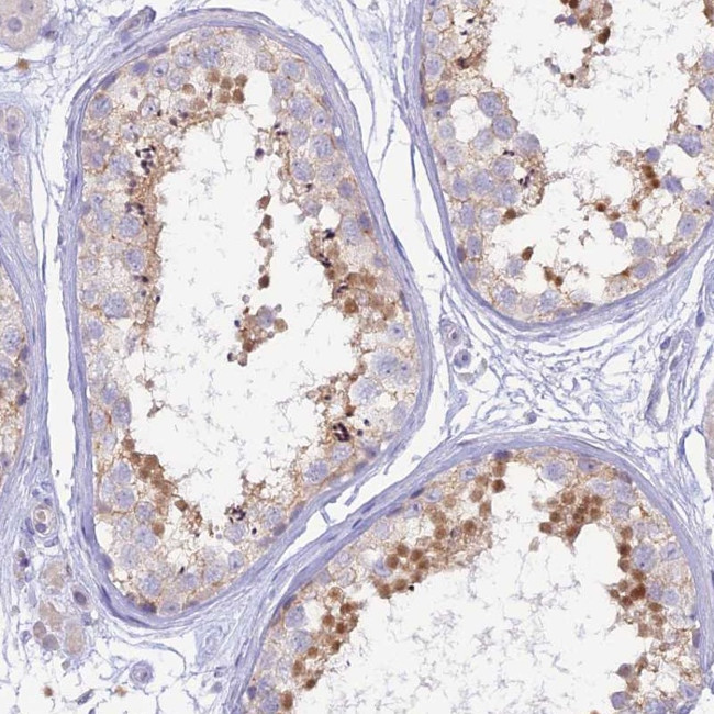 MBD3L1 Antibody in Immunohistochemistry (Paraffin) (IHC (P))