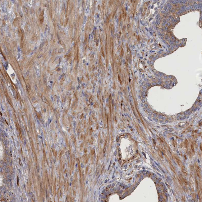 FILIP1L Antibody in Immunohistochemistry (Paraffin) (IHC (P))