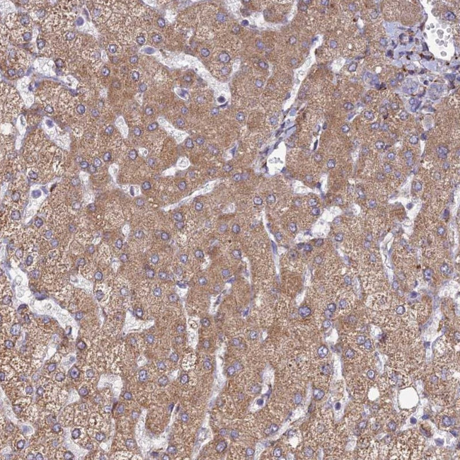 RCN3 Antibody in Immunohistochemistry (Paraffin) (IHC (P))