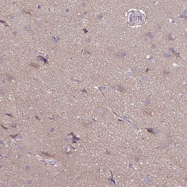 FSD1 Antibody in Immunohistochemistry (Paraffin) (IHC (P))