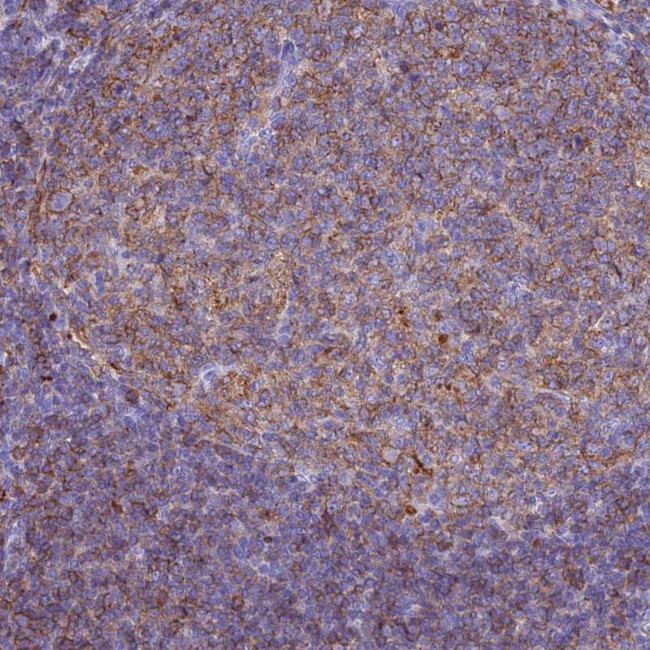 HLA-DRB1 Antibody in Immunohistochemistry (Paraffin) (IHC (P))