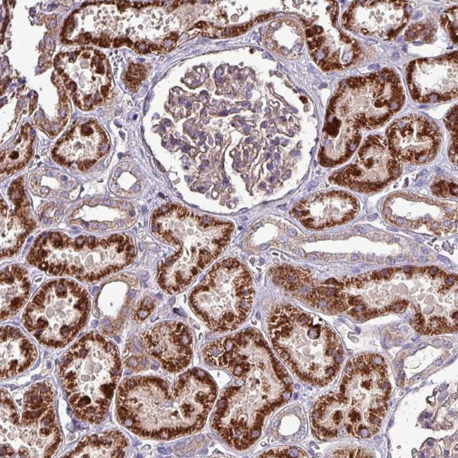 ZNF322A Antibody in Immunohistochemistry (Paraffin) (IHC (P))