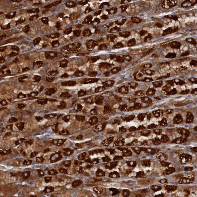 TMEM196 Antibody in Immunohistochemistry (Paraffin) (IHC (P))