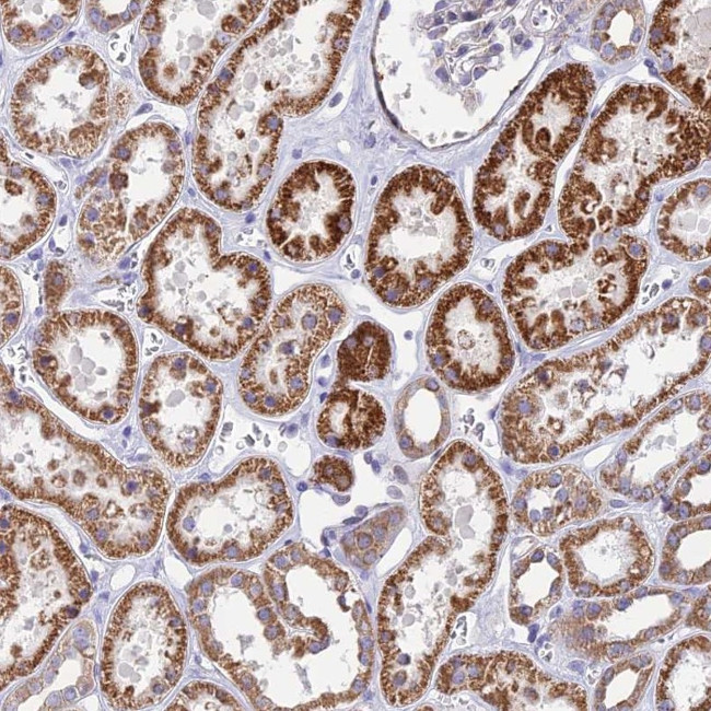 DOC2B Antibody in Immunohistochemistry (Paraffin) (IHC (P))