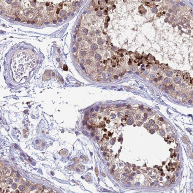 THAP5 Antibody in Immunohistochemistry (IHC)
