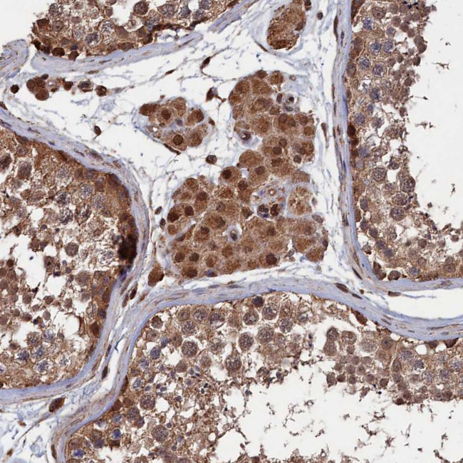 PDE12 Antibody in Immunohistochemistry (Paraffin) (IHC (P))
