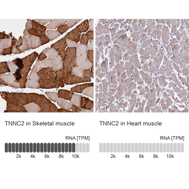 TNNC2 Antibody in Immunohistochemistry (IHC)