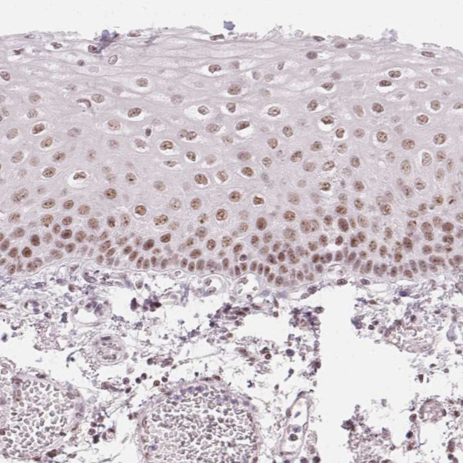 KLHDC9 Antibody in Immunohistochemistry (Paraffin) (IHC (P))