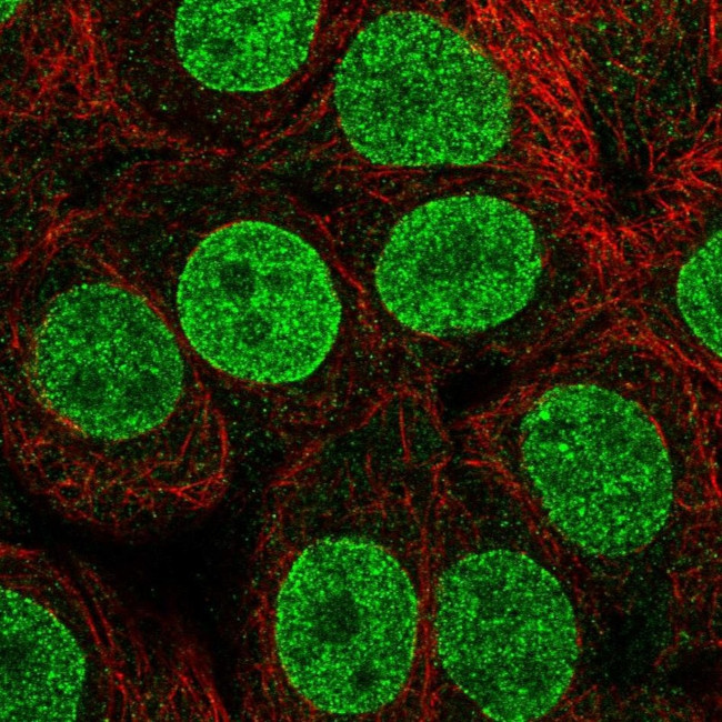 TETRAN Antibody in Immunocytochemistry (ICC/IF)