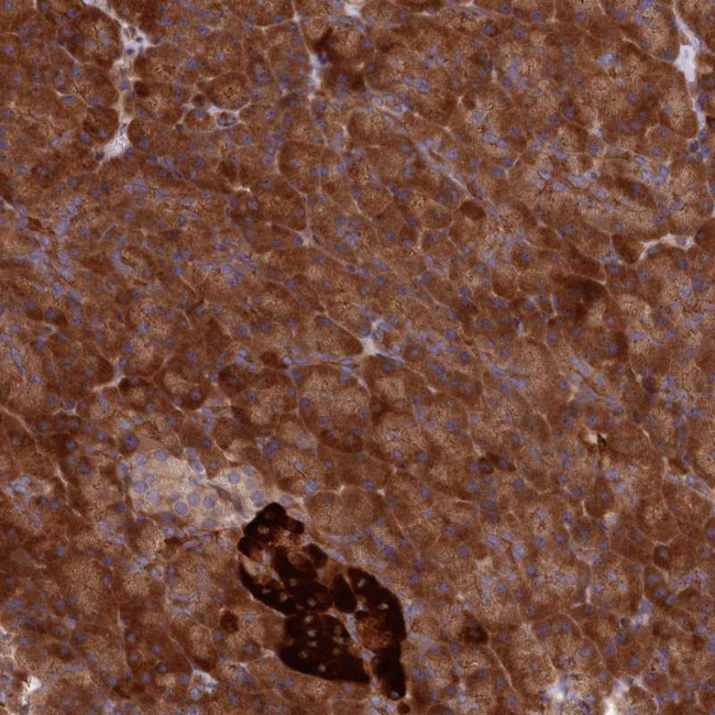 DDX60L Antibody in Immunohistochemistry (Paraffin) (IHC (P))