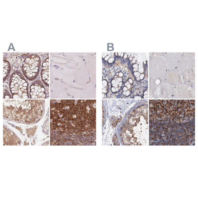 ANKRD13A Antibody in Immunohistochemistry (IHC)