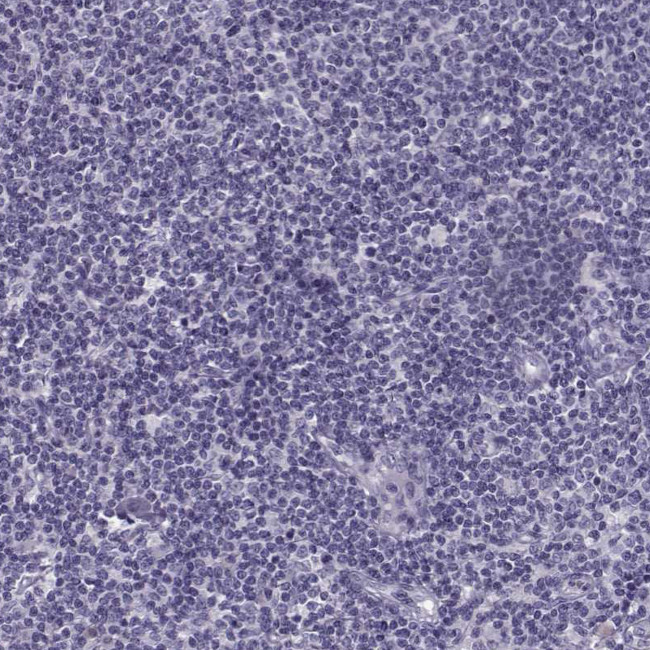 GAGE1 Antibody in Immunohistochemistry (Paraffin) (IHC (P))