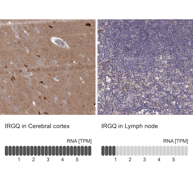IRGQ Antibody in Immunohistochemistry (IHC)