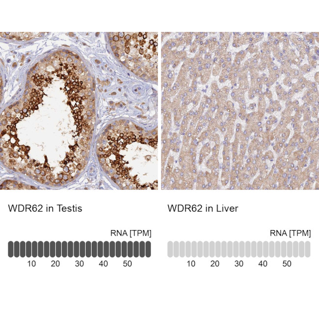 WDR62 Antibody in Immunohistochemistry (IHC)